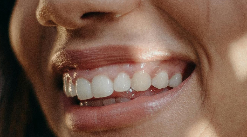 La soluzione moderna per un sorriso funzionale ed estetico